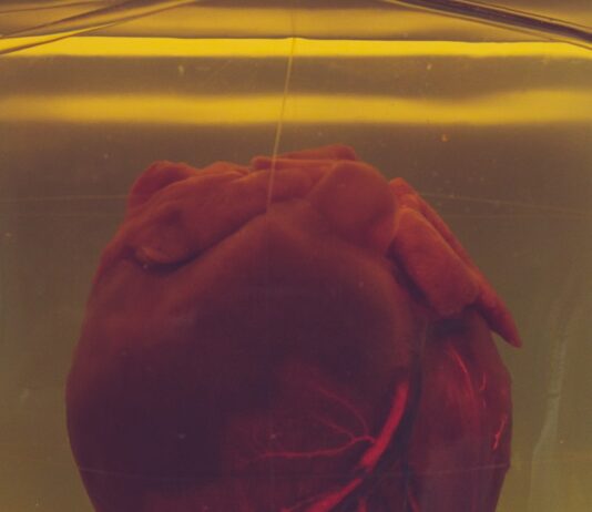 심혈관 건강을 지키는 식단 관리, 건강한 심장의 첫걸음 human heart